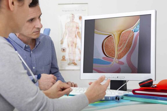 Prostata Biopsie - Weniger Stanzproben, geringere Belastung in der Prostata-MRT Prostata Biopsie - Weniger Stanzproben, geringere Belastung in der Prostata-MRT