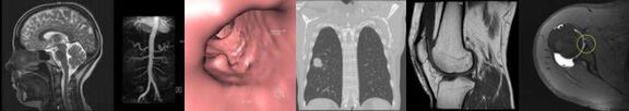 MRT, CT, Ultraschall oder Röntgen - ein breites Untersuchungsspektrum erlaubt präzise Diagnosen