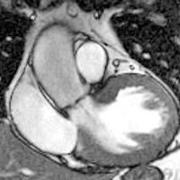 Magnetresonanztomographie (Kernspintomographie, MRT): Diagnostik angeborener oder erworbener Herzfehler, krankhafter Veränderungen der Herzklappen sowie Erkrankungen des Herzmuskels – beispielsweise einer Herzmuskelentzündung